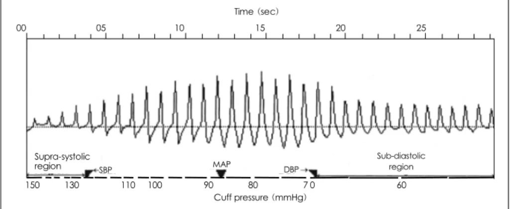 Fig. 1. Graphic display of oscillometric signal derived using a cuff sphygmomanometer