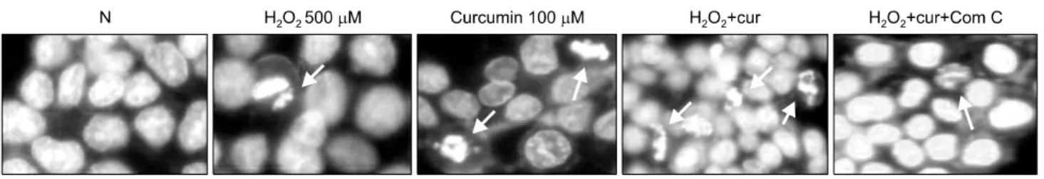 Fig. 2.  Apoptotic  effect  of  H 2 O 2   and  curcumin  combination.  Apoptotic  bodies  were  measured  by  Hochest  33342  staining