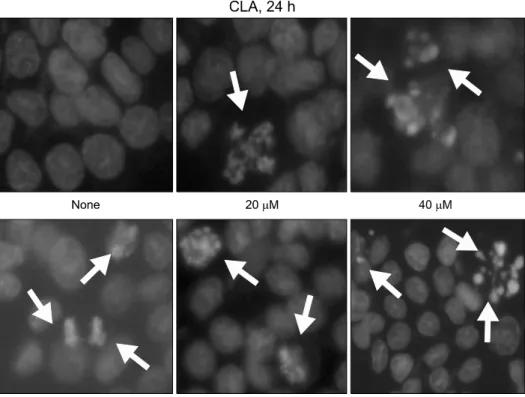 Fig. 2. Apoptotic effects of CLA in  HT-29  colon  cancer  cells.  HT-29  colon cancer cells  were  treated  at  different  concentration  with  CLA  (20∼320μM)  for  24  h  and   mea-sured  by  Hoechst 33342  staining