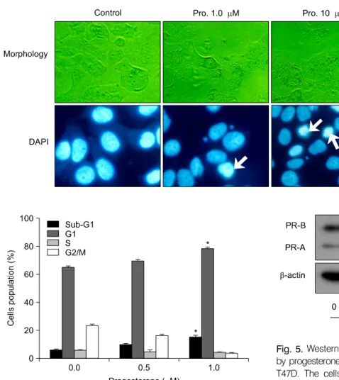 Fig. 3. Characterization of proges- proges-terone-induced  apoptotic  cell  death.  T47D  cells  were  cultured  without  (control)  or  with   proges-terone  (1  and  10μM)  for  48  hr