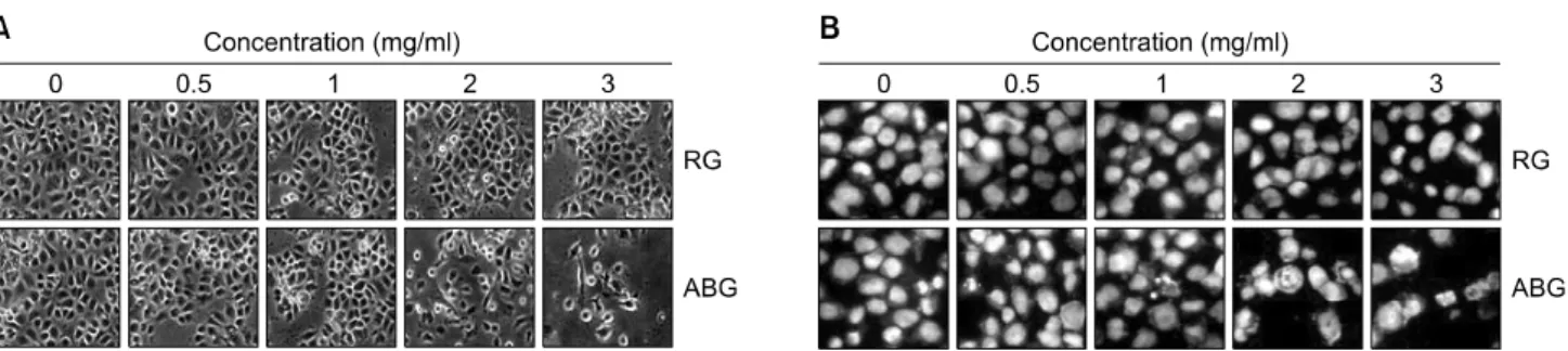 Fig. 2. Morphological changes and nuclear chromatin condensation of AGS cells by ABG treatment