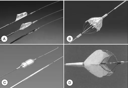 Fig. 2. Filter device system. The Filterwire EX ®  system (A), the AngioGuard ®  system (B), the MedNova Neuroshield ®  sys- sys-tem (C), the Accunet syssys-tem ®  (D)