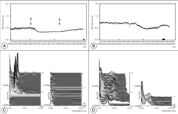 Fig. 2. RR tachogram (A) and compressed spectral array (C) from a 67 year-old normal control during dipyridamole infusion