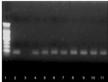 Fig. 1. Immunohistochemical detection of p16 INK4a  in  breast cancer. A  combination  of  nuclear  and cytoplasmic  staining  was  seen  in  some  breast  tumors  (A),  whereas  the  staining  in  other  tumors  was  completely  absent  (B).