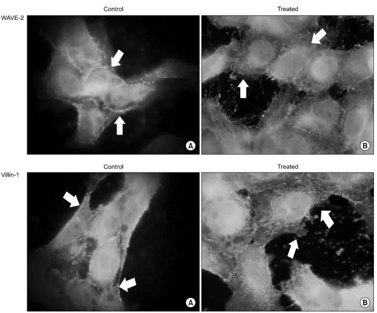 Fig. 7. Immunofluorescence of WAVE2 and Villin1 on cytoskeletal modification. In Rac-dependent cytoskeletal modification pathway,  WAVE2 and  Villin1  effected on  the  changes  of  cell  morphology