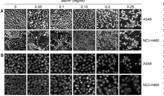 Fig. 2.  Morphological  changes  and  apoptotic  body  formation  of  A549  and  NCI-H460  cells  by  MEHF  treatment