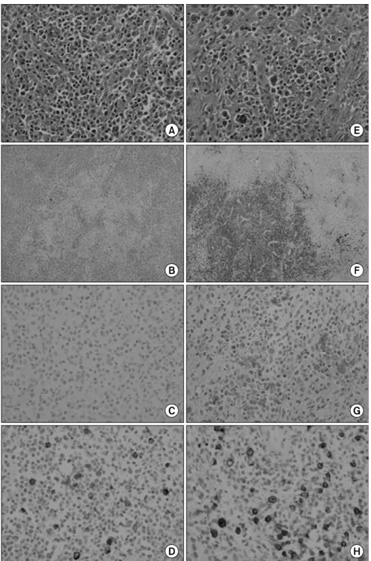 Fig. 1.  Histological  examinations  of  inguinal  lymph  node.  T-cell  area (A∼D)  and  anaplastic  B-cell  area (E∼H)