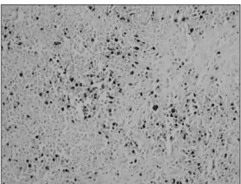 Table  1.  Results  of  immunostaining  experiments  and  In  Situ  Hybridization  (ISH)  analysis  of  Epstein-Barr  Virus-Encoded  Small  RNAs  (EBER)