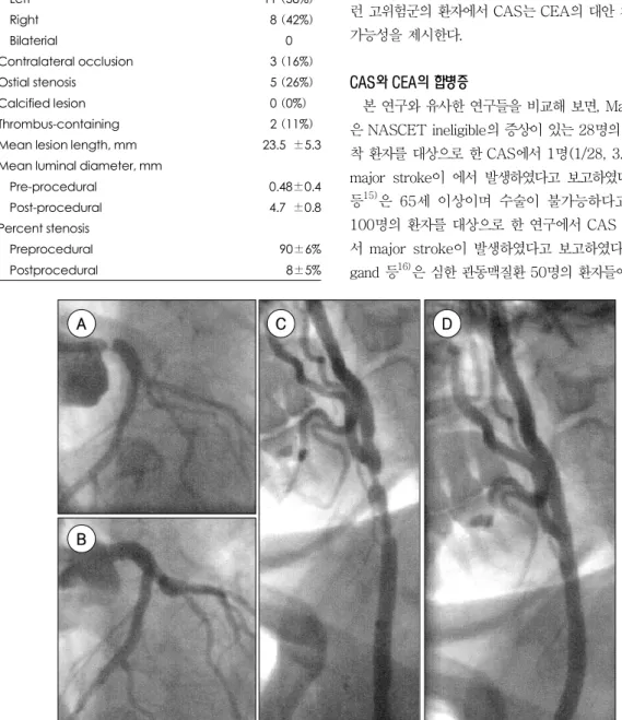 Fig. 1. Stenting of severe left main coronary artery and right internal carotid atery at one-stage in a 60-year-old wo- wo-man who refused CABG and CEA