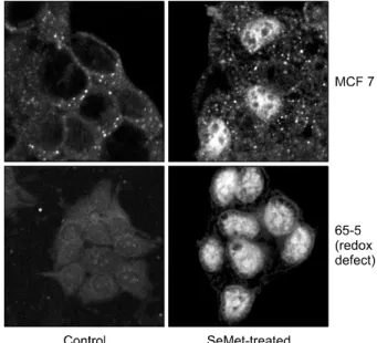 Fig. 2.  PTEN  protein  expression  in  the  presence  with  SeMet. 