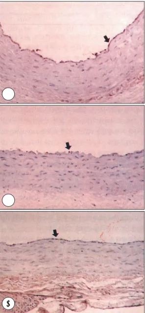 Fig. 4. H &amp; E staining of rat aorta. A：control group. B：
