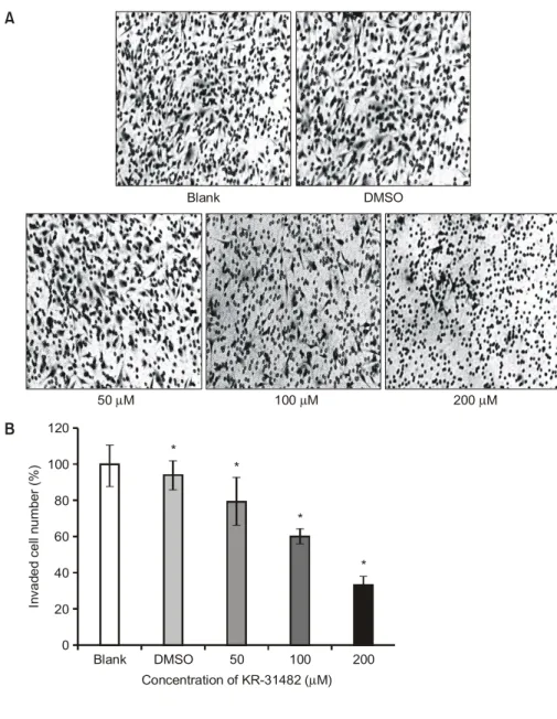 Fig. 6. KR-31482 reduces gelatinase activity in BAECs. The gelatinase activity and expression in endothelial cells were  stu-died using gelatin-based zymography (For details see Materials and Methods) and were appeared as clear band.