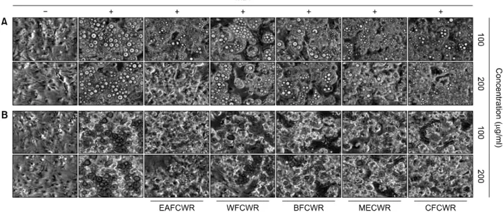 Fig. 3.  Effects  of  C.  wilfordii  Radix  extracts  on  lipid  droplet  accumulation  of  differentiated  3T3-L1  mouse  preadipocytes