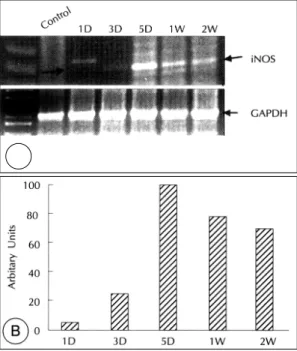 Fig. 5. Representative RT-PCR demonstrating iNOS mRNA expression in balloon-deendothelialized arteries