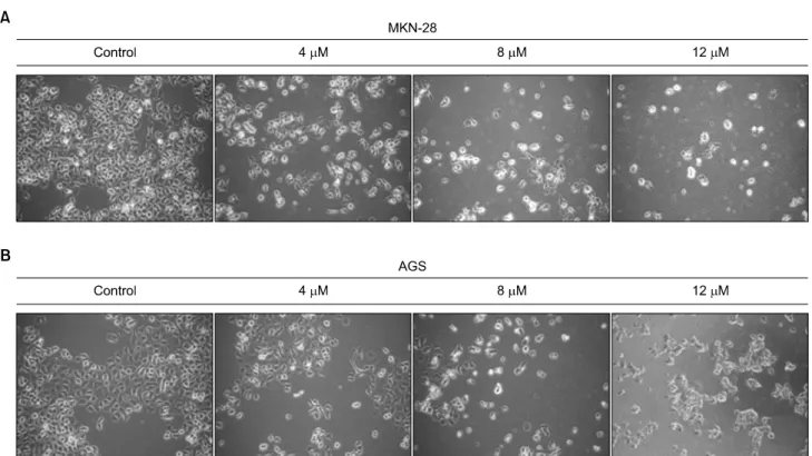 Fig. 2.  Morphological  changes  of  MKN-28  (A)  and  AGS  (B)  cells  were  analyzed  as  increase  of  AP1  concentration