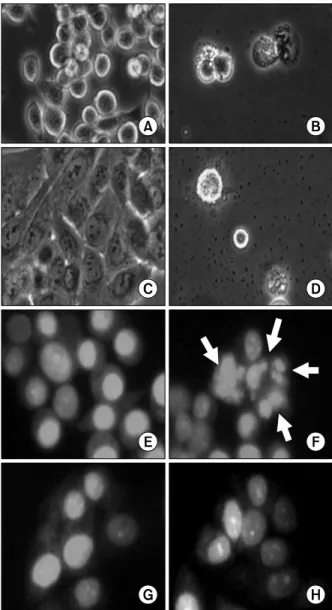 Fig. 2.   Microphotographs  of  human  gastric  cancer  cells  treated  with  urushiol
