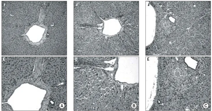 Fig. 10. (A) Light microscopic view of liver in control rat. Well preserved hepatic architecture without inflammatory activity or necrosis.
