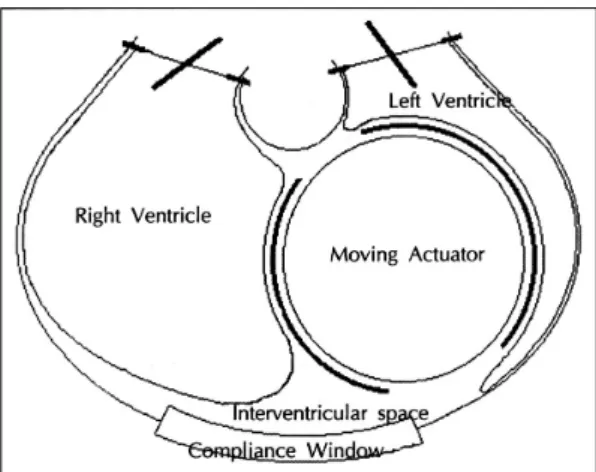 Fig. 1. Diagram of the moving actuator artificial heart. 