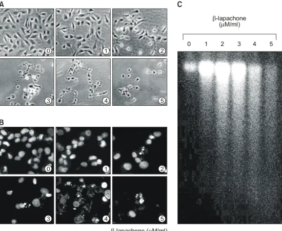 Fig.  2.  Morphological  changes,  chromatin  chondensation  and  DNA  fragmentation  by  β-lapachone  treatment  in  A549  human  lung  carcinoma  cells