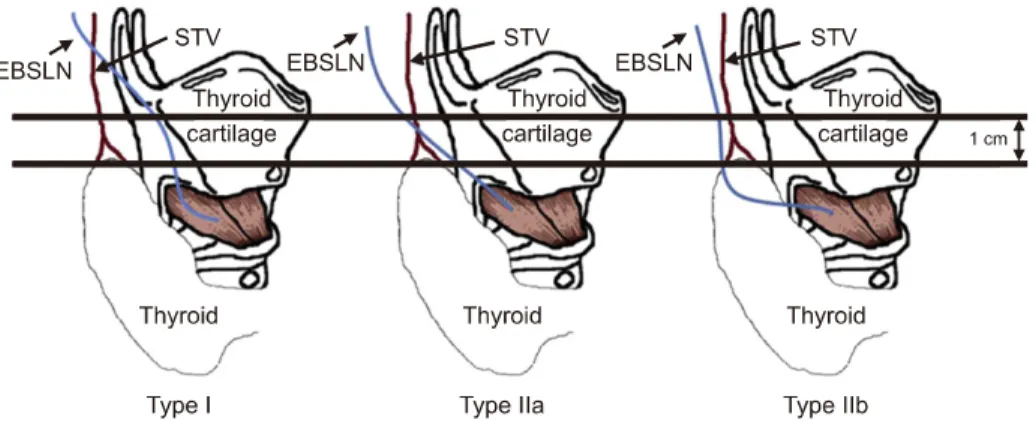 Fig.  1.  Cernea  classification  of  the  EBSLN.  In  type  I,  the  EBSLN  crosses  the  superior  thyroidal  vessels  at  least  1  cm above  the  plane  horizontal  to  the  upper  edge  of  the  superior  thyroid  pole;  in  type  IIa,  the  distance 