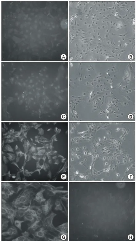 Fig.  3.  Characterization  of  immortalized  cells.  Immortalized  cells  exhibited  immunoreactivity  for  Nestin  (E);  magnification  of  Nestin-positive  cells  (G),  not  NSE  (A)  and  GFAP  (C)