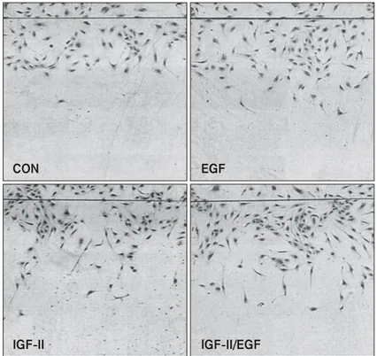 Fig.  5.  Effect  of  IGF-II  and/or  EGF  on  migration  of  HUVECs.  Each  of  EGF  (5  ng/ml)  and  IGF-II  (100  ng/ml)  stimulated  the  migration  of  HUVECs