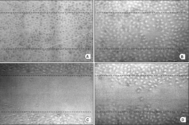 Fig.  8.  Effects  of  the  Dahuang  and  Soamsan  on  migration  of  ECV304  cells  induced  by  SNU638  CM