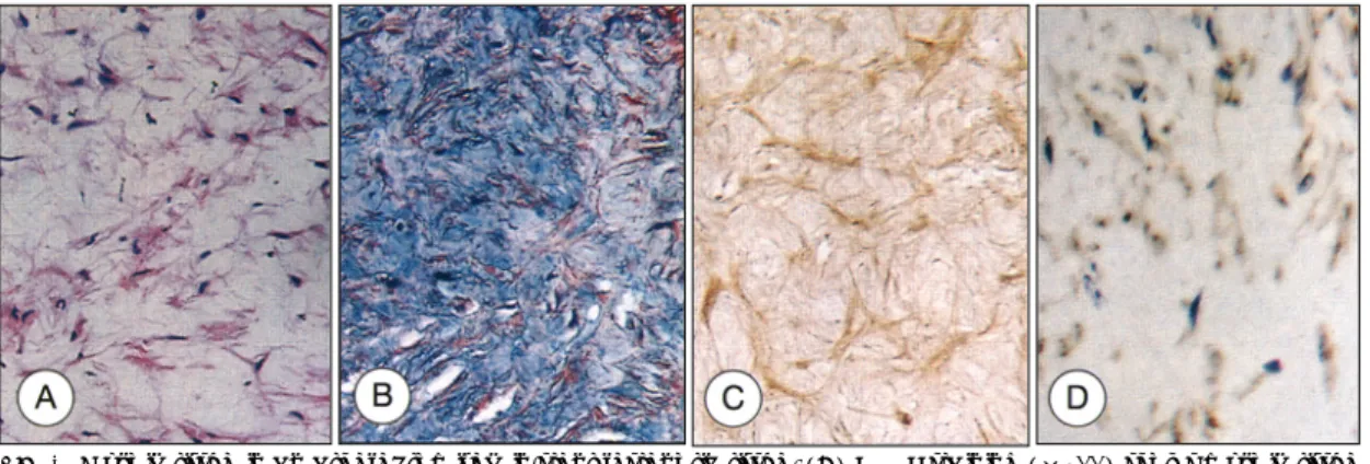 Fig. 4. Myxoid tissue in an atherectomized in-stent restenotic tissue. (A) H &amp; E staining (×200) shows myxoid tissue characterized by stellate SMCs in the loose ECM
