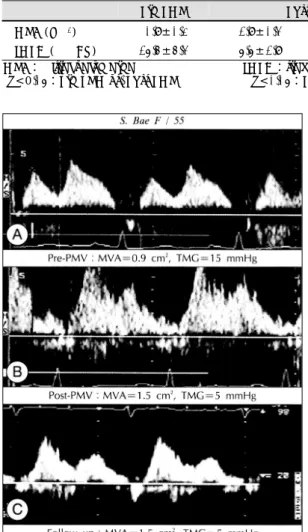 Fig. 1. Pulsed-wave Doppler flow measured at the right