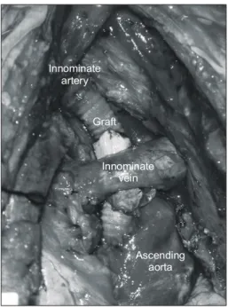 Fig. 4. 3D reconstruction of postoperative CT scan.