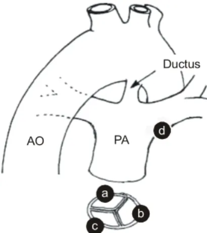 Fig. 2. The ejection fraction increased from 41.2±10.3% to  60.5±15.8% within 1 month and to 59.8±13.9% within 1 year  after operation