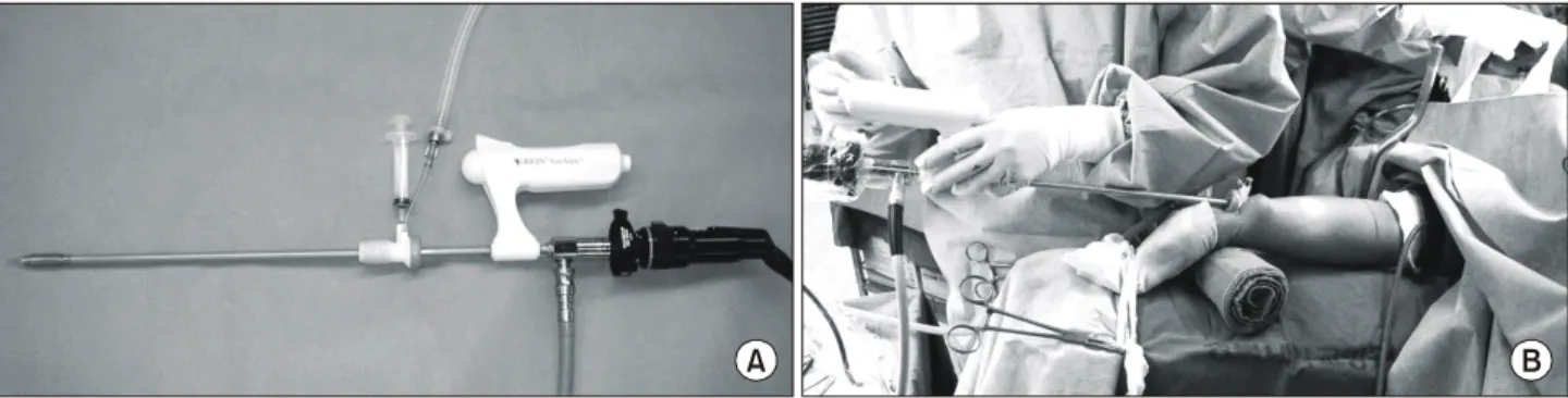 Fig. 3. (A) The bipolar electrocautery scissors and endoscope is inserted to the Uniport Plus dissection cannula