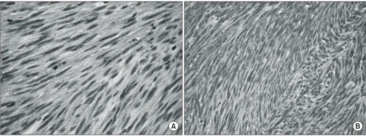 Table 1. Tumor size and mitotic rate as guides to the eval- eval-uation of GIST malignancy