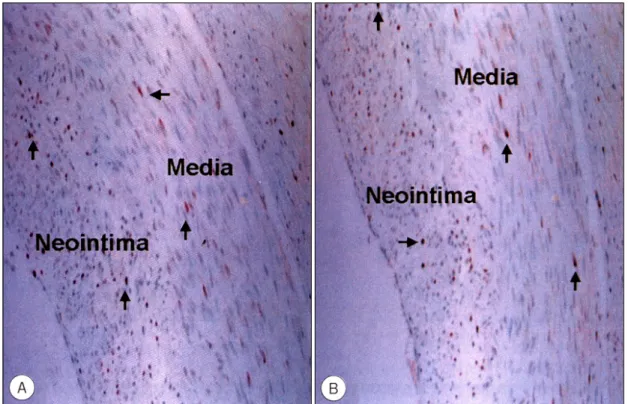 Fig. 4. Proliferative cell nuclear antigen(PCNA) indices of neointima and media were similar in control artery (A) and radiated artery (B)