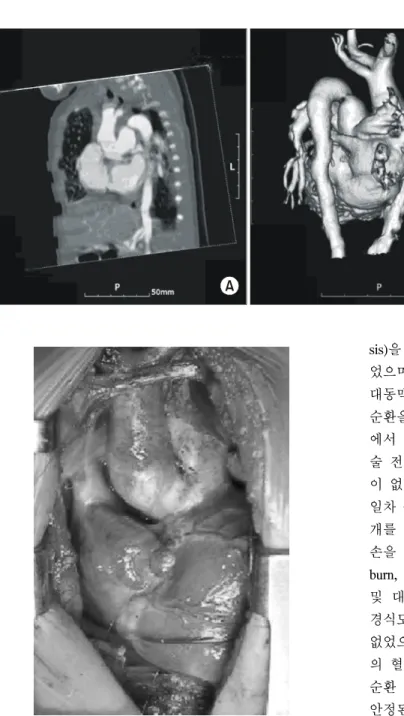 Fig. 2.  Operative  photography.