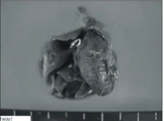 Fig. 3. The effect of obstruction of the pulmonary vein on right  ventricular hypertrophy in rats