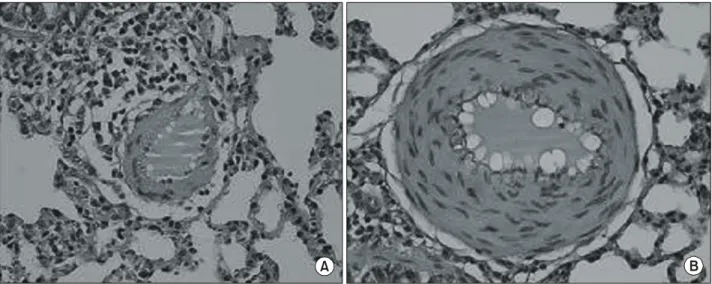 Fig. 4. Photomicrographs of left lung section to confirm vascular wall thickness (Hematoxylin-Eosin stain, ×400)