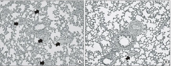 Fig. 9. The effect of obstrction of the pulmonary vein on arterial  density. Arterial desity is number of small peripheral pulmonary  arteries per 100 alveoli
