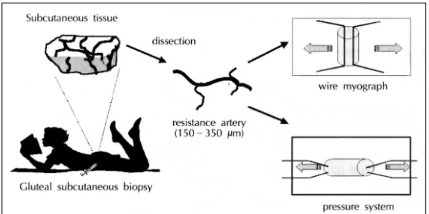 Fig. 7. Two different techniques for  the study of human small vessel  re-modeling in vitro：one is the wire  myograph method (which is  initi-ally designed for functional studies  of small vessels), and the other is  the pressurized artery preparation  (wh