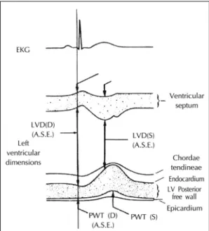 Fig. 1. Schematic diagram of M-mode of the left ven- ven-tricle. The left ventricular interval dimension at  end-diastole was measured at on set of the QRS complex  and systolic (S) measurement was done at the maximal  excursion of the ventricular septum