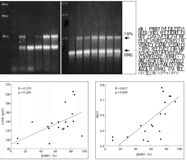 Fig. 4. RT-PCR sample of pa- pa-tients. After completion of  PCR, each sample was run  on the agarose gel and  qu-antitated relative density of  βARK1 compared with  gly-ceraldehy-de-3-phosphate  dehydrogenase (GAPDH) by  SigmaGel ®  with UV exposed  photo