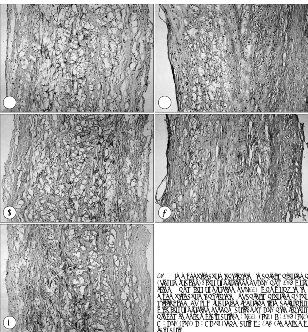 Fig. 1. Immunohistochemical staining in carotid atheroma  (frozen section). The expressions of DR3 and 139 were  strong, and the expression of R110 was weak in  im-muno-histochemical staining of carotid atheroma