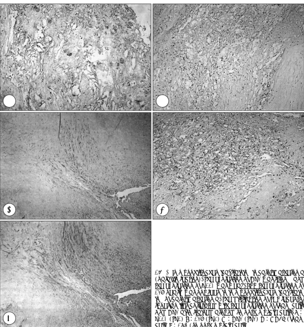 Fig. 2. Immunohistochemical staining in carotid atheroma  (paraffin section). The expression of DR3 was strong, and  the expression of R110 was weak