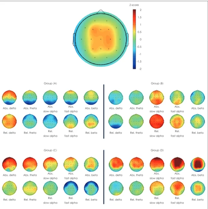 Fig. 2. The difference in topography between the 4 subtypes divided by cluster analysis of quantitative electroencephalogram
