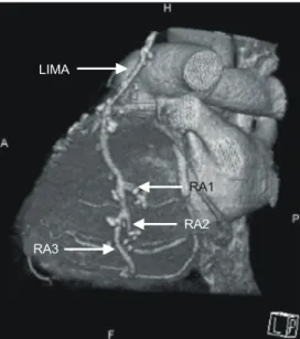 Table 4. Graft patency