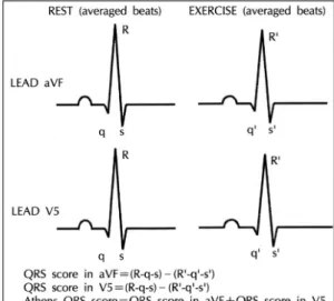 Table 2. QRS scores of the patients and control A  Patients  Control A  p value 