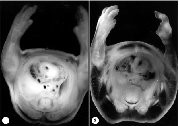 Fig. 4. Short axis section of the agar mount of the embryo at day 16. Section was made at the level of the thorax and the upper arm