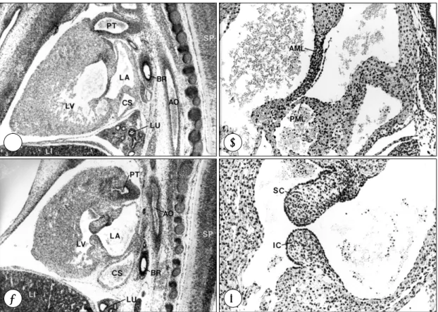Fig. 8. Histologic sections of the hearts at the left atrioventricular valve in the long axis plane parallel to the ventricular septum