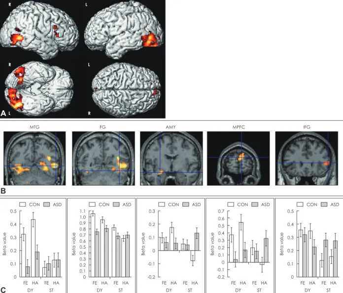 Fig. 3. Brain regions in which ASD group showed reduced activity compared to CON group under dynamic versus static conditions