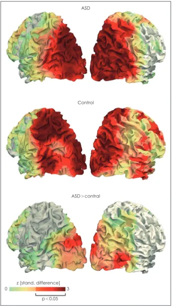 Fig. 1. Cortical distribution of the positive linear modulation of  gamma-band activity by motion coherence